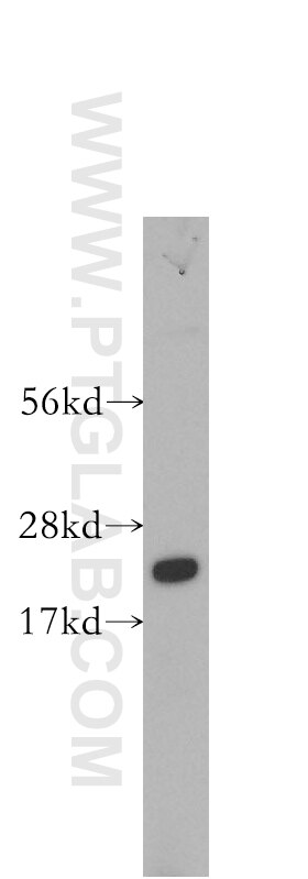 Western Blot (WB) analysis of human pancreas tissue using RABAC1 Polyclonal antibody (10542-1-AP)