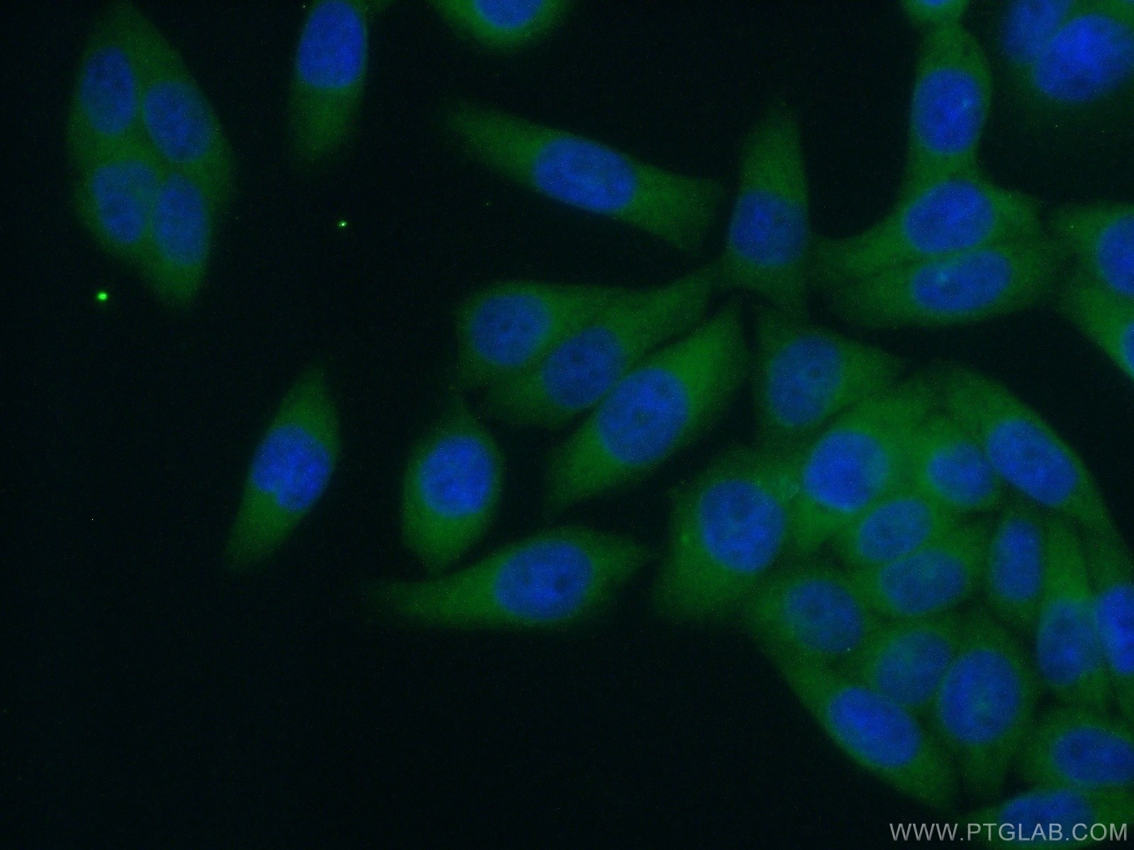 Immunofluorescence (IF) / fluorescent staining of HeLa cells using RABEP1 Polyclonal antibody (14350-1-AP)