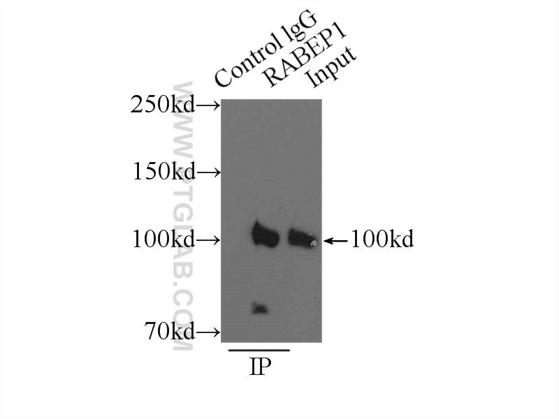 Immunoprecipitation (IP) experiment of HeLa cells using RABEP1 Polyclonal antibody (14350-1-AP)