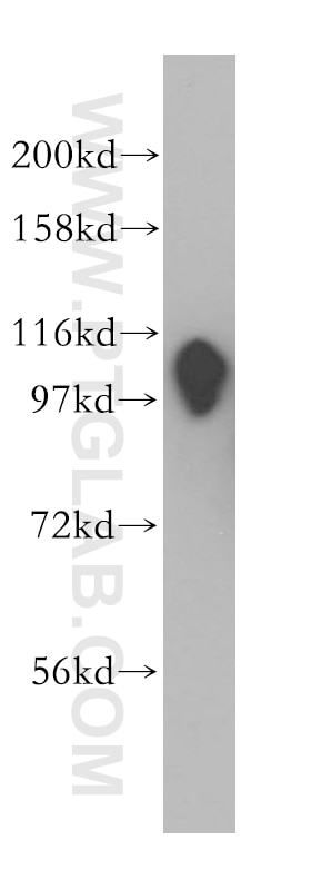 Western Blot (WB) analysis of A431 cells using RABEP1 Polyclonal antibody (14350-1-AP)