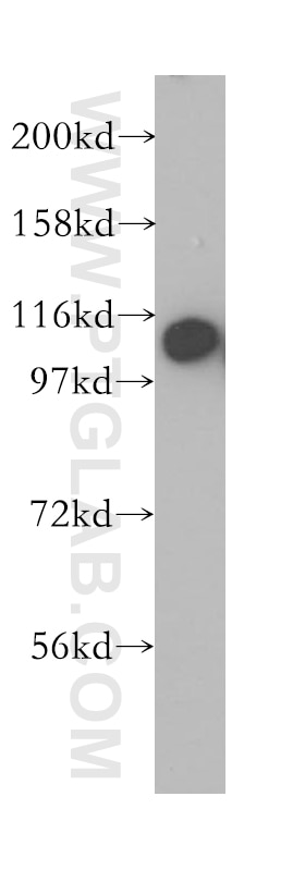 Western Blot (WB) analysis of human liver tissue using RABEP1 Polyclonal antibody (14350-1-AP)