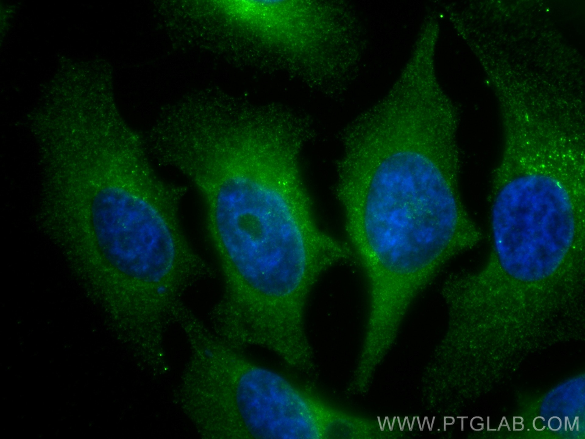 Immunofluorescence (IF) / fluorescent staining of HeLa cells using RABEP1 Monoclonal antibody (68285-1-Ig)