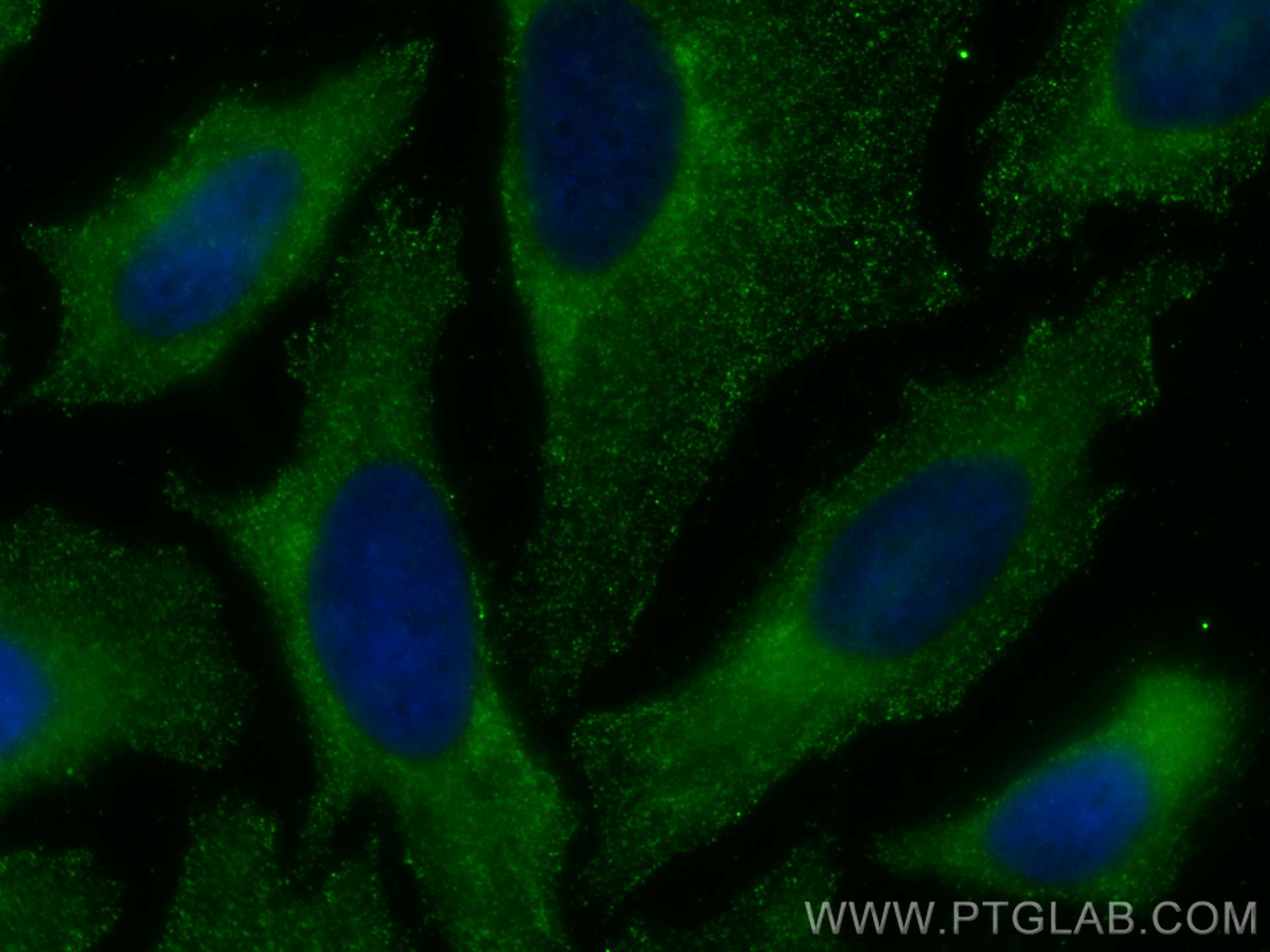 Immunofluorescence (IF) / fluorescent staining of HeLa cells using RABEP1 Monoclonal antibody (68285-1-Ig)