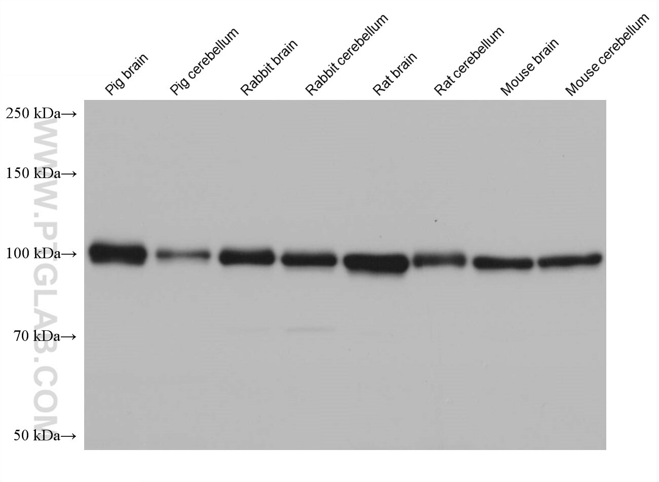 Western Blot (WB) analysis of various lysates using RABEP1 Monoclonal antibody (68285-1-Ig)