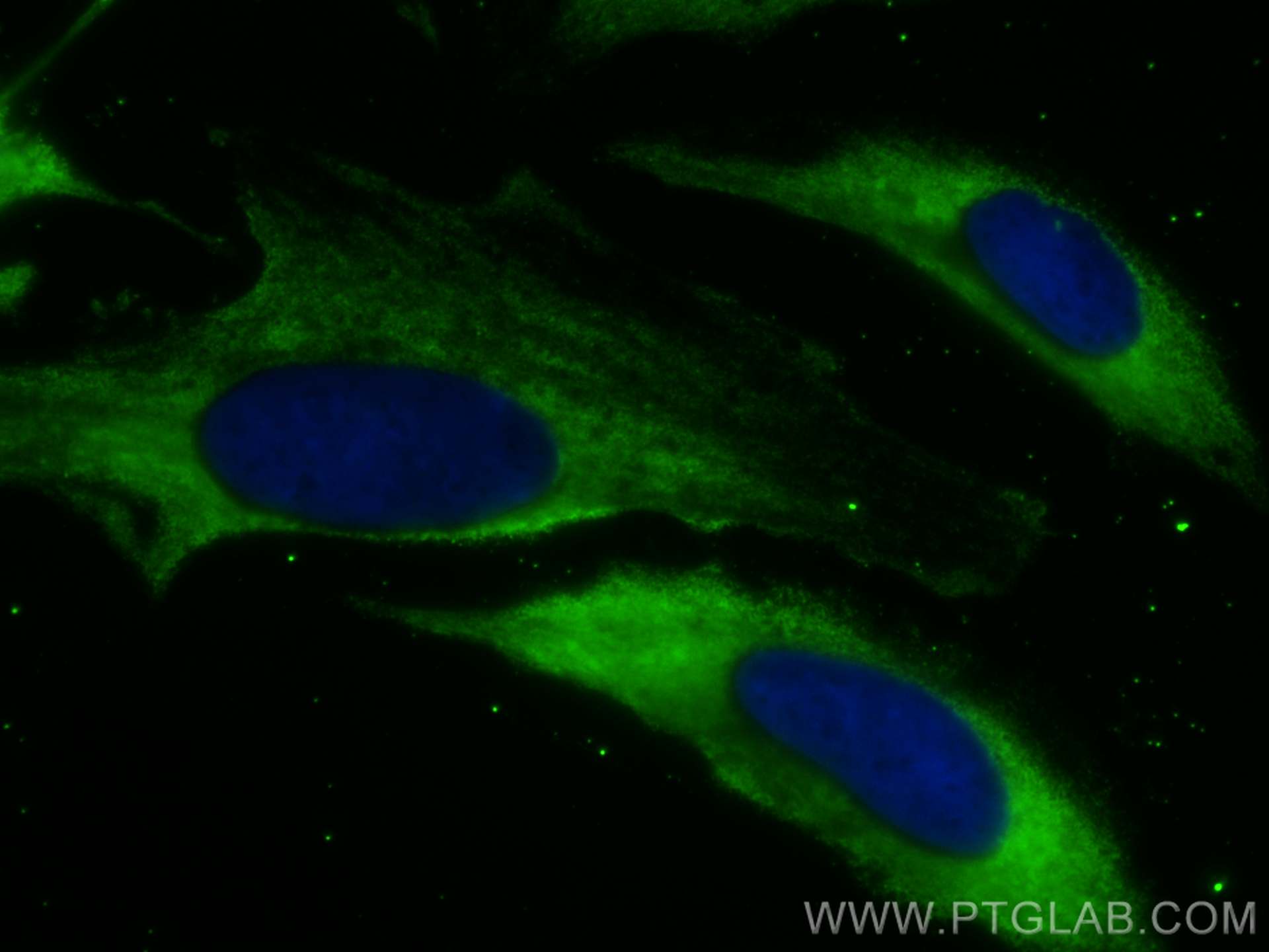 Immunofluorescence (IF) / fluorescent staining of HeLa cells using CoraLite® Plus 488-conjugated RABEP1 Monoclonal an (CL488-68285)