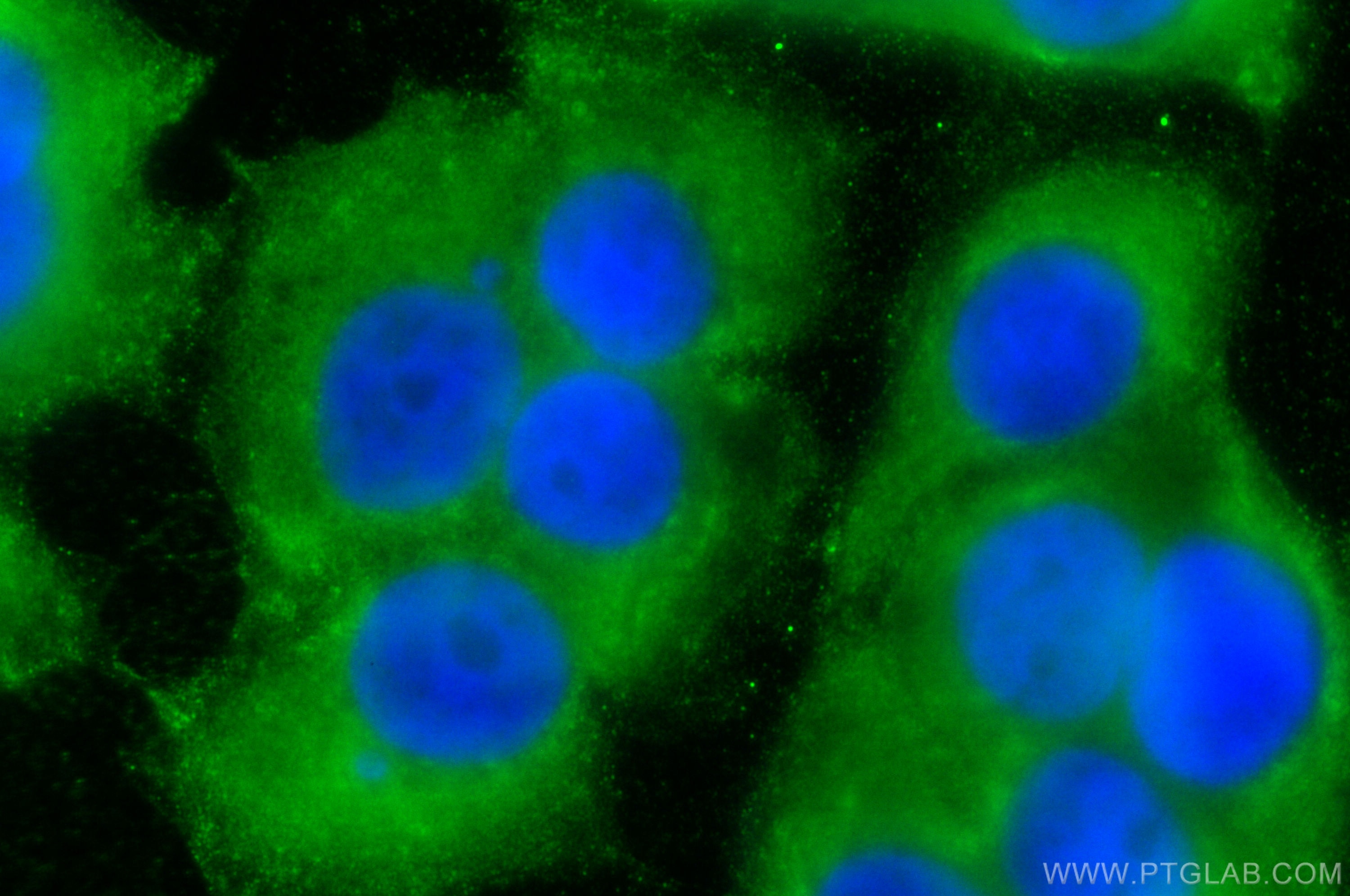 Immunofluorescence (IF) / fluorescent staining of MCF-7 cells using RABEP2 Polyclonal antibody (14625-1-AP)