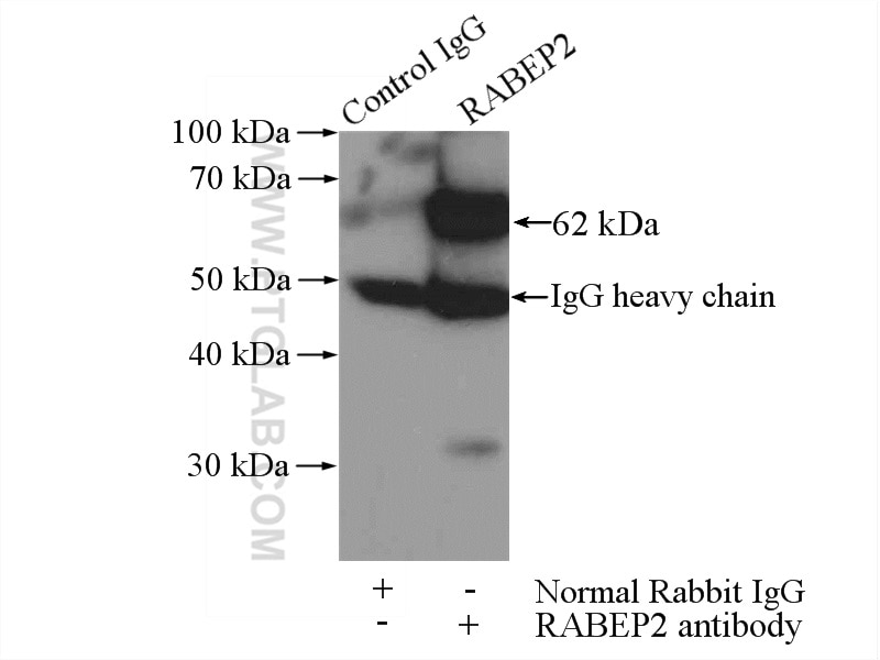 Immunoprecipitation (IP) experiment of mouse liver tissue using RABEP2 Polyclonal antibody (14625-1-AP)