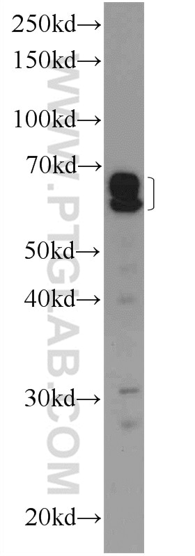 Western Blot (WB) analysis of mouse liver tissue using RABEP2 Polyclonal antibody (14625-1-AP)