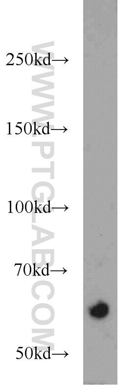 Western Blot (WB) analysis of Jurkat cells using RABEP2 Polyclonal antibody (14625-1-AP)