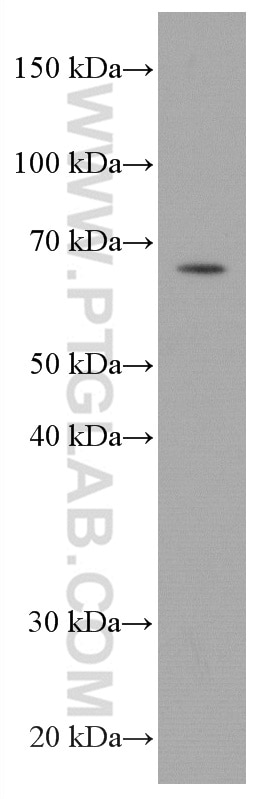 Western Blot (WB) analysis of Jurkat cells using RABEP2 Monoclonal antibody (60125-1-Ig)