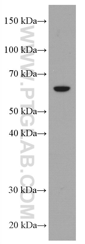 Western Blot (WB) analysis of HSC-T6 cells using RABEP2 Monoclonal antibody (60125-1-Ig)