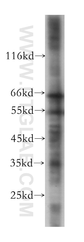 Western Blot (WB) analysis of PC-3 cells using RABEP2 Monoclonal antibody (60125-1-Ig)