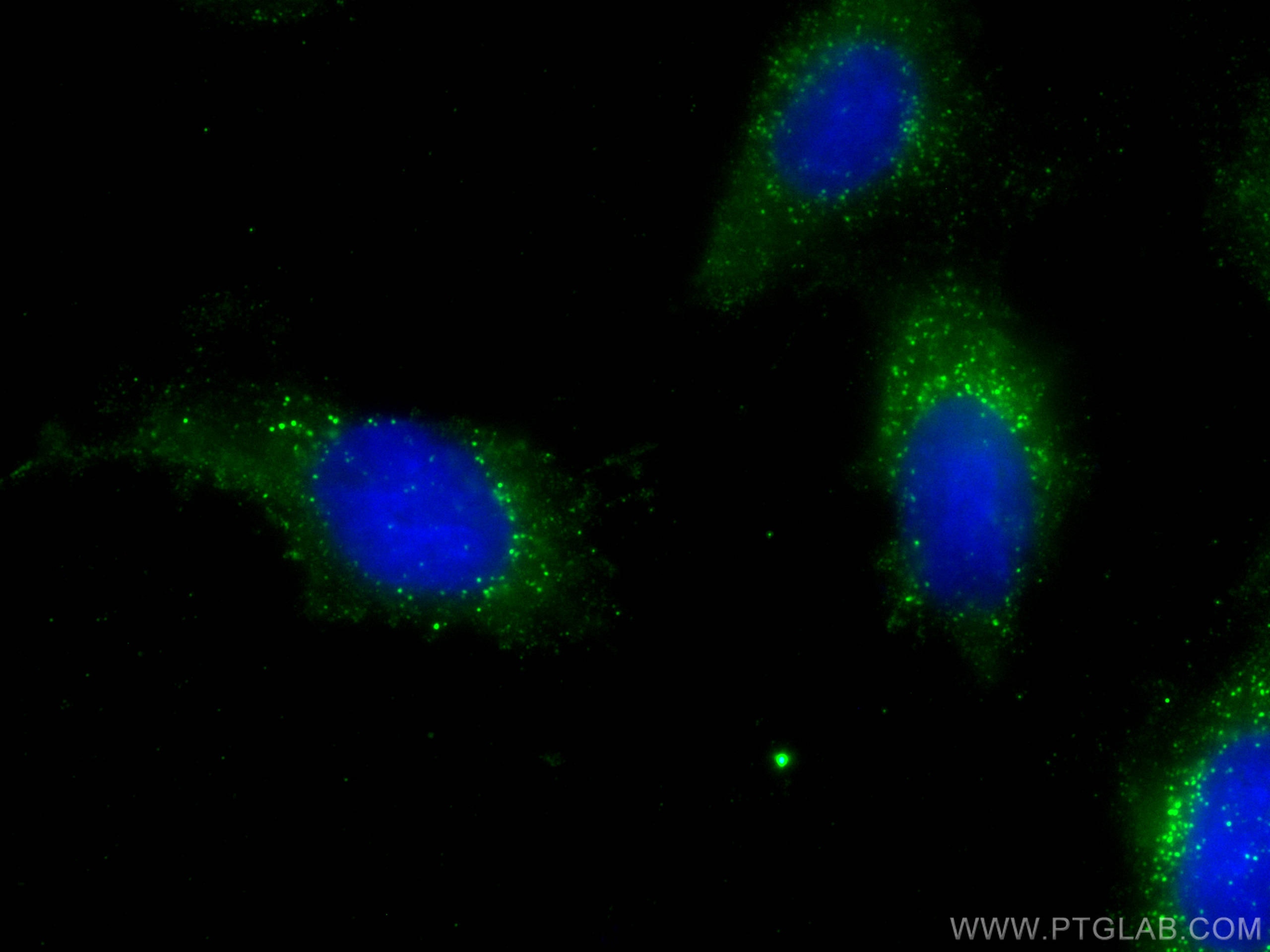 Immunofluorescence (IF) / fluorescent staining of H9C2 cells using CoraLite® Plus 488-conjugated RABEP2 Monoclonal an (CL488-60125)