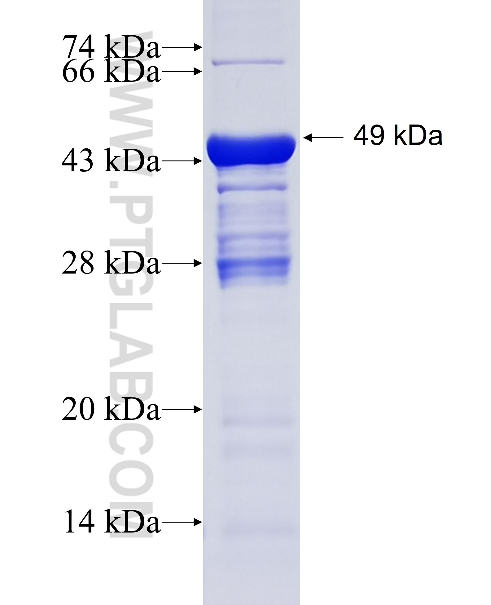 RABEP2 fusion protein Ag6197 SDS-PAGE