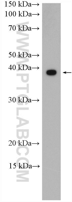 Western Blot (WB) analysis of K-562 cells using RABEPK/p40 Polyclonal antibody (10213-2-AP)