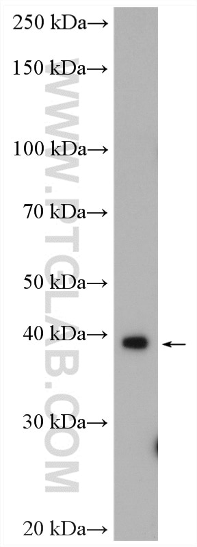 Western Blot (WB) analysis of HeLa cells using RABEPK/p40 Polyclonal antibody (10213-2-AP)