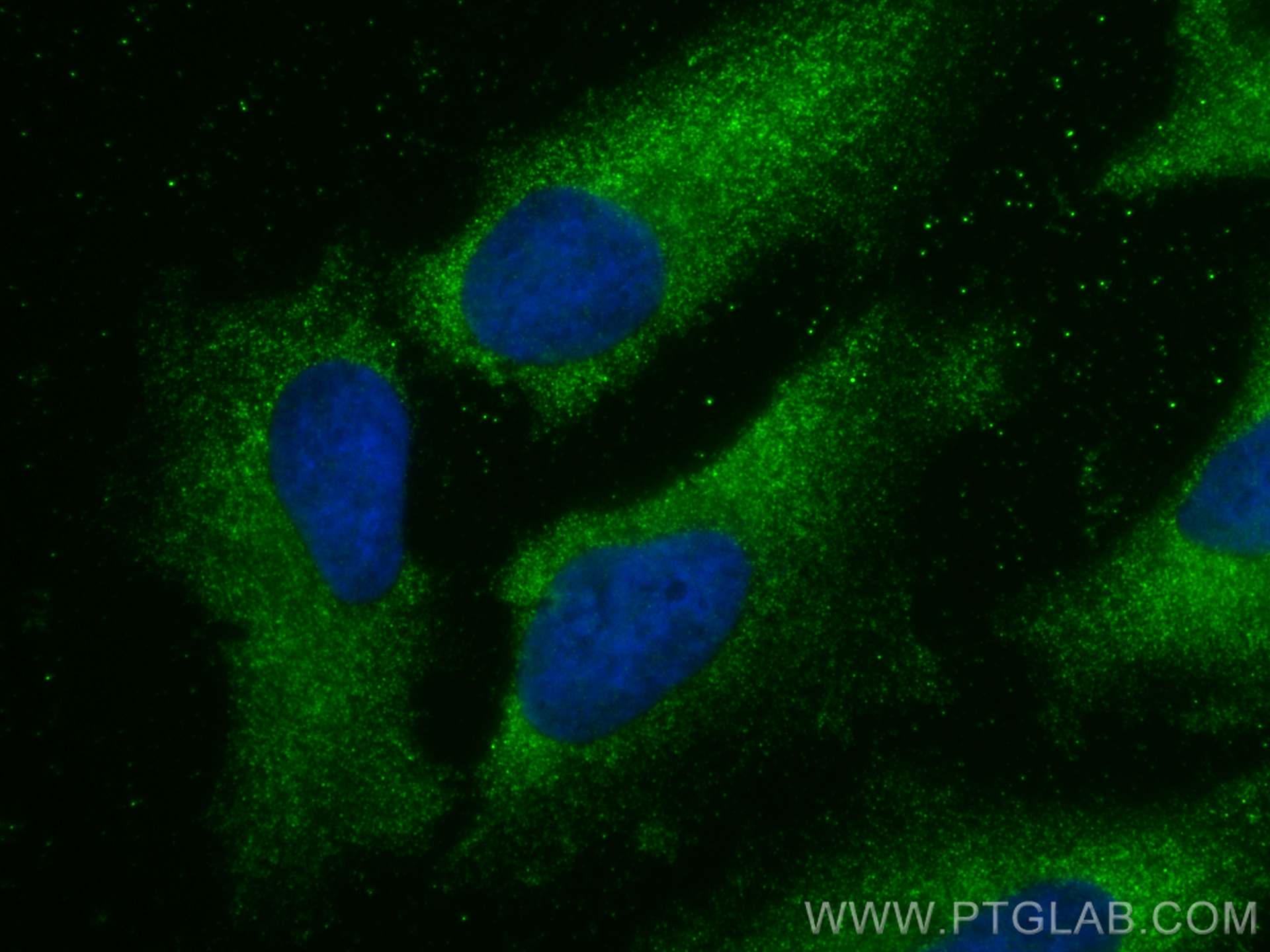 Immunofluorescence (IF) / fluorescent staining of HeLa cells using RABEPK/p40 Polyclonal antibody (15105-1-AP)