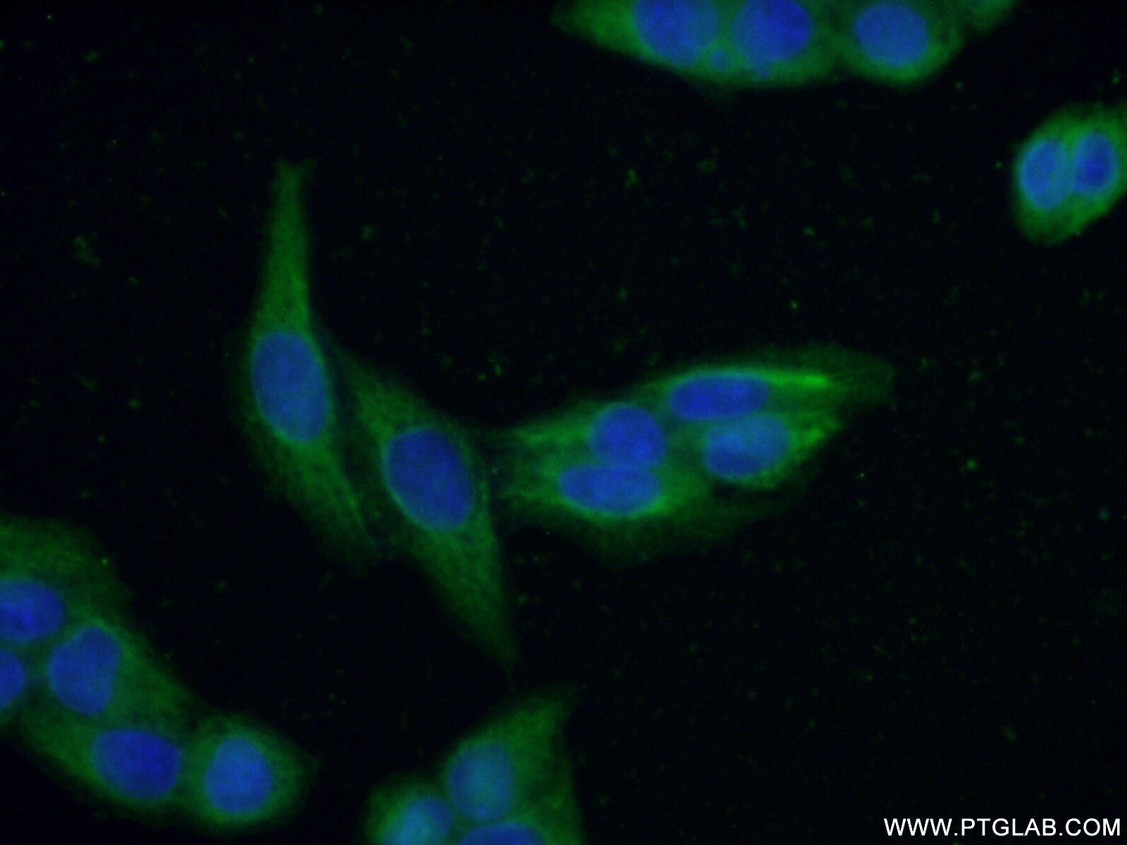 Immunofluorescence (IF) / fluorescent staining of HeLa cells using RABEPK/p40 Polyclonal antibody (15105-1-AP)