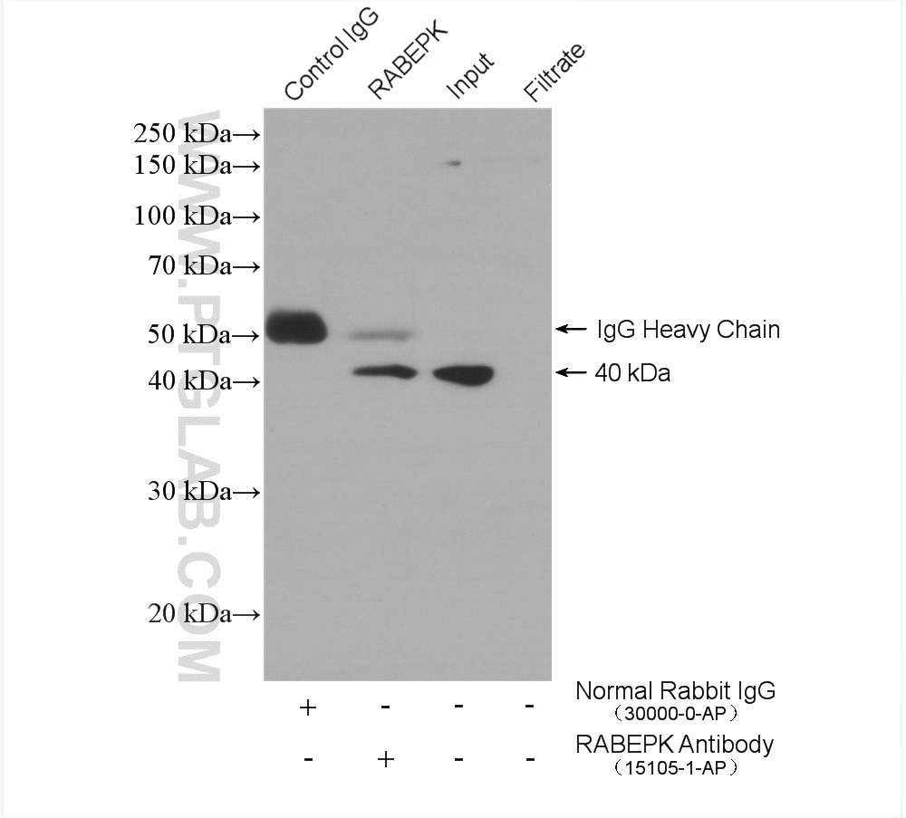Immunoprecipitation (IP) experiment of HeLa cells using RABEPK/p40 Polyclonal antibody (15105-1-AP)
