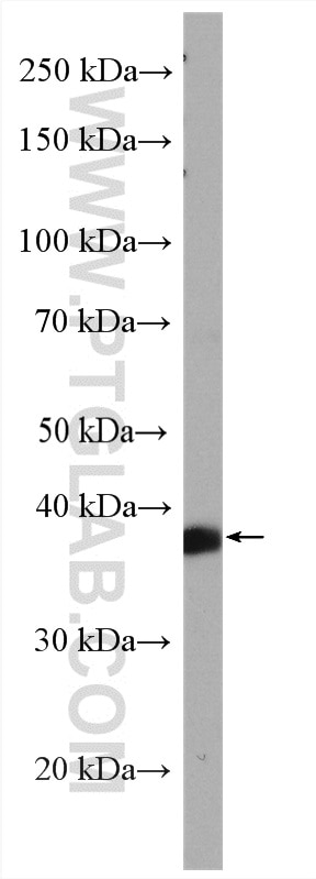 Western Blot (WB) analysis of HeLa cells using RABEPK/p40 Polyclonal antibody (15105-1-AP)