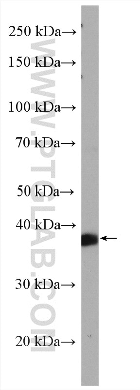 WB analysis of HeLa using 15105-1-AP