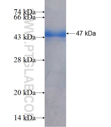 RABEPK fusion protein Ag7796 SDS-PAGE