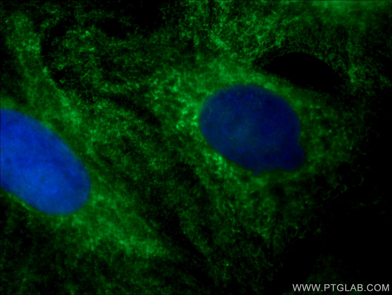 Immunofluorescence (IF) / fluorescent staining of A549 cells using RABEPK/p40 Monoclonal antibody (66622-1-Ig)