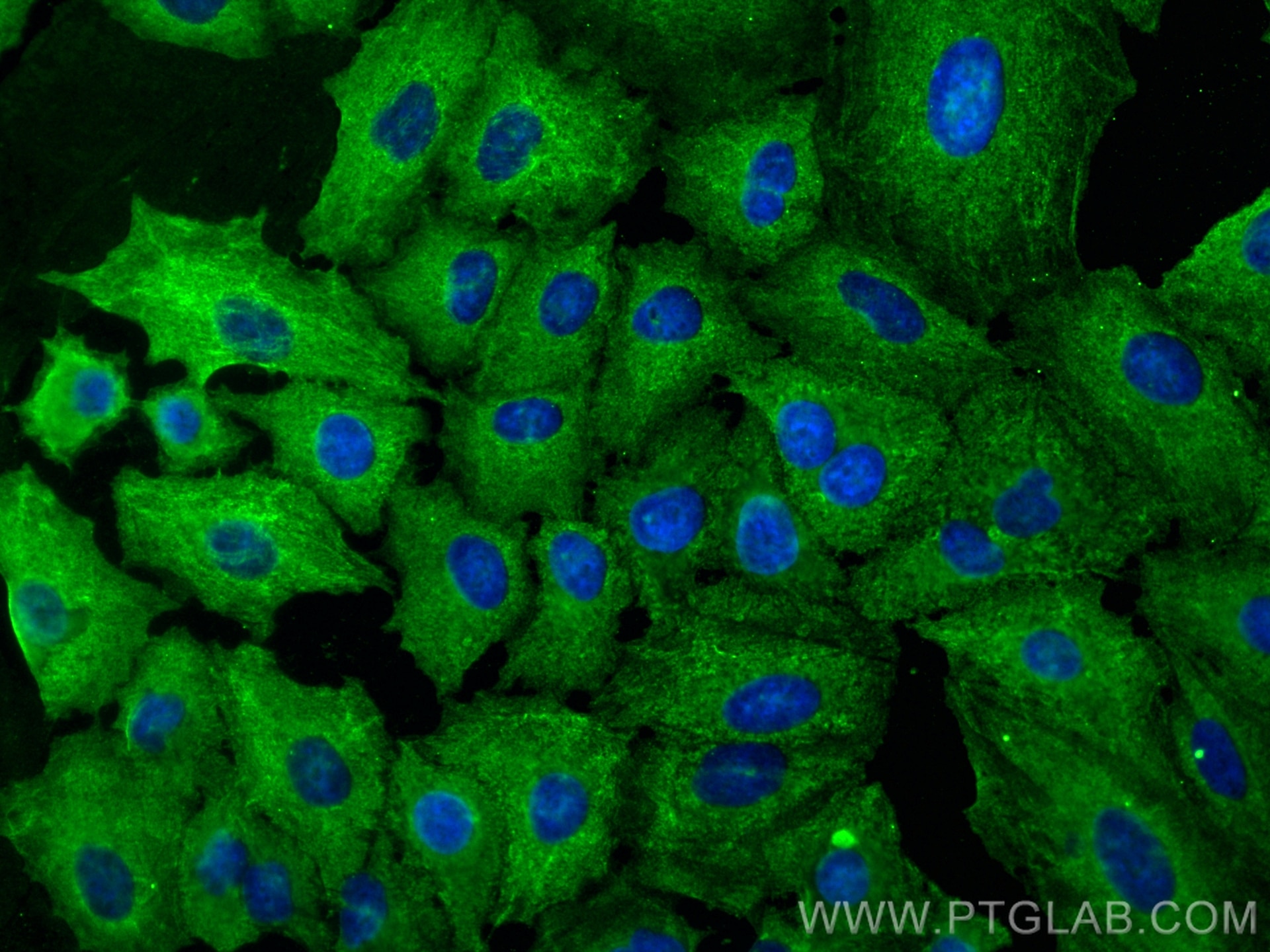 Immunofluorescence (IF) / fluorescent staining of A549 cells using RABEPK/p40 Monoclonal antibody (66622-1-Ig)