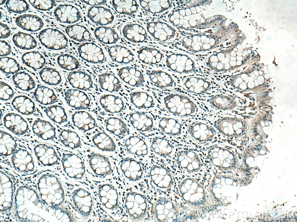 Immunohistochemistry (IHC) staining of human colon tissue using RABEPK/p40 Monoclonal antibody (66622-1-Ig)