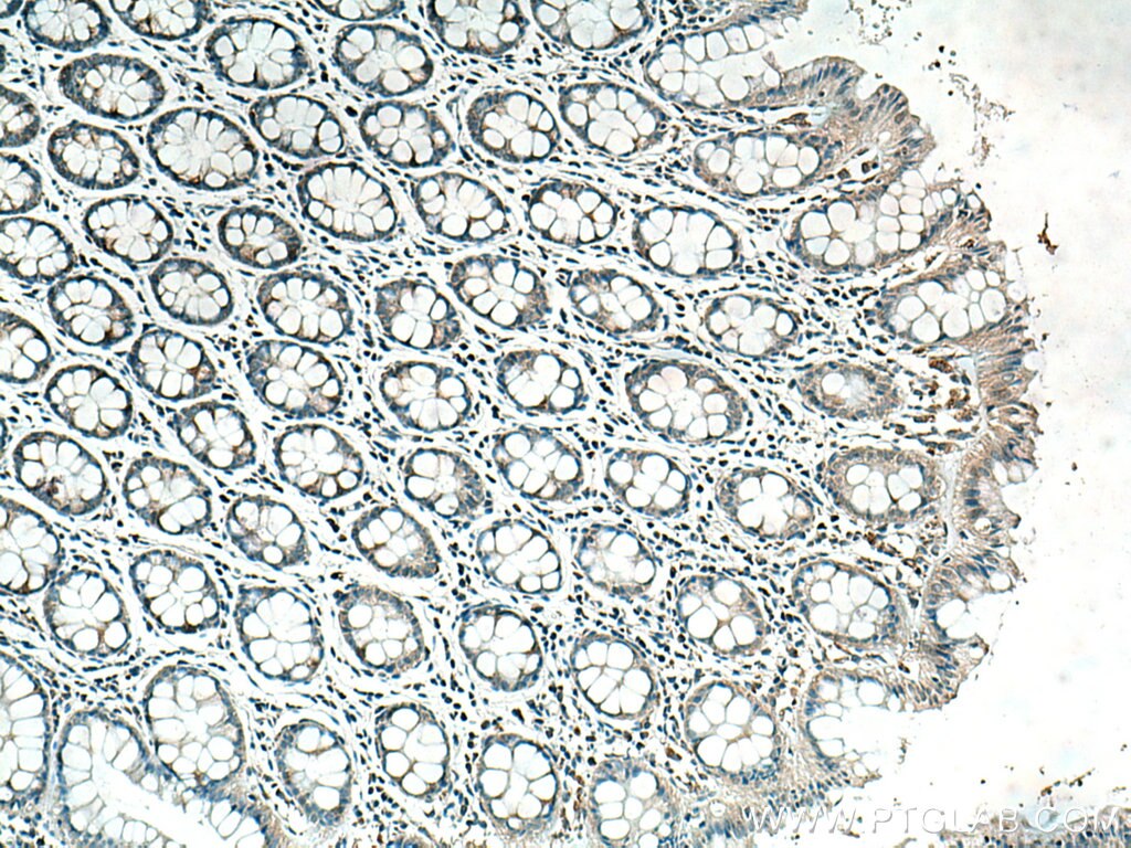 IHC staining of human colon using 66622-1-Ig