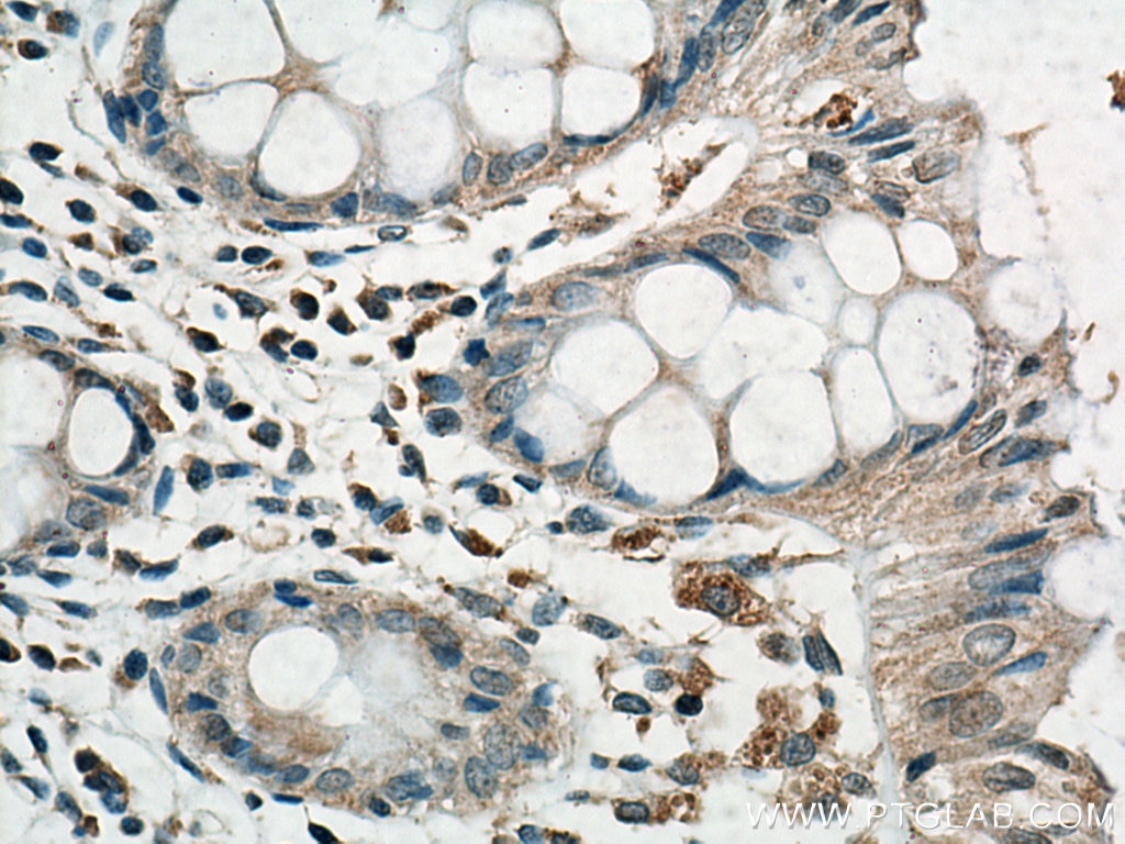 Immunohistochemistry (IHC) staining of human colon tissue using RABEPK/p40 Monoclonal antibody (66622-1-Ig)