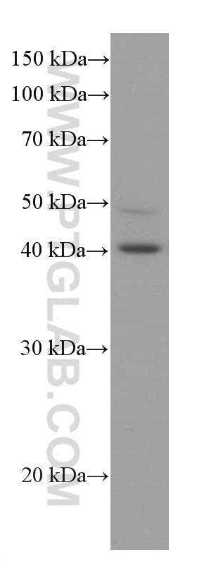 Western Blot (WB) analysis of HeLa cells using RABEPK/p40 Monoclonal antibody (66622-1-Ig)