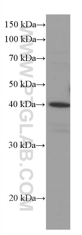 Western Blot (WB) analysis of HEK-293 cells using RABEPK/p40 Monoclonal antibody (66622-1-Ig)