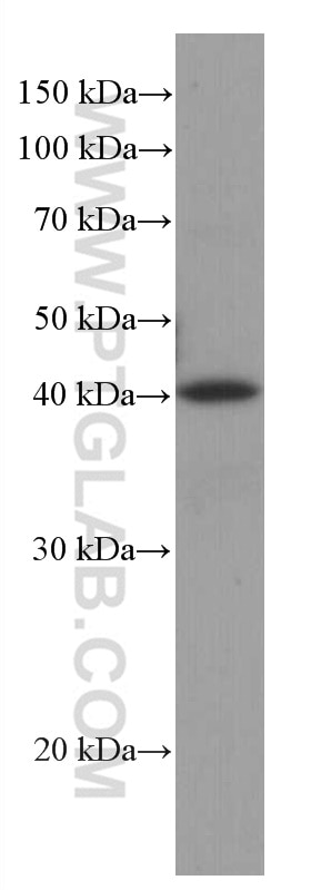 Western Blot (WB) analysis of Jurkat cells using RABEPK/p40 Monoclonal antibody (66622-1-Ig)