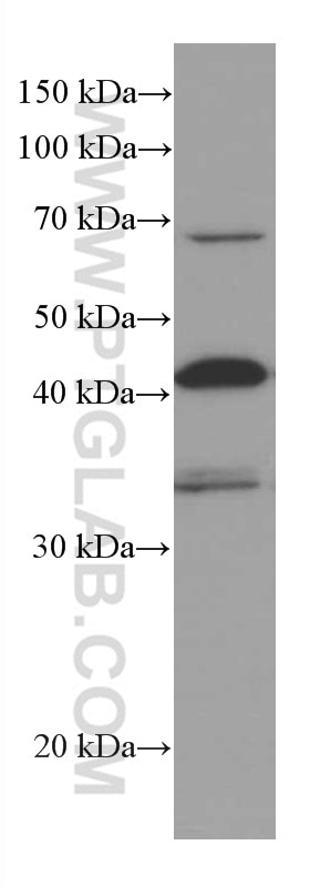 Western Blot (WB) analysis of HSC-T6 cells using RABEPK/p40 Monoclonal antibody (66622-1-Ig)