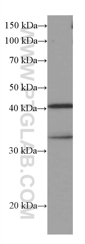 Western Blot (WB) analysis of RAW 264.7 cells using RABEPK/p40 Monoclonal antibody (66622-1-Ig)