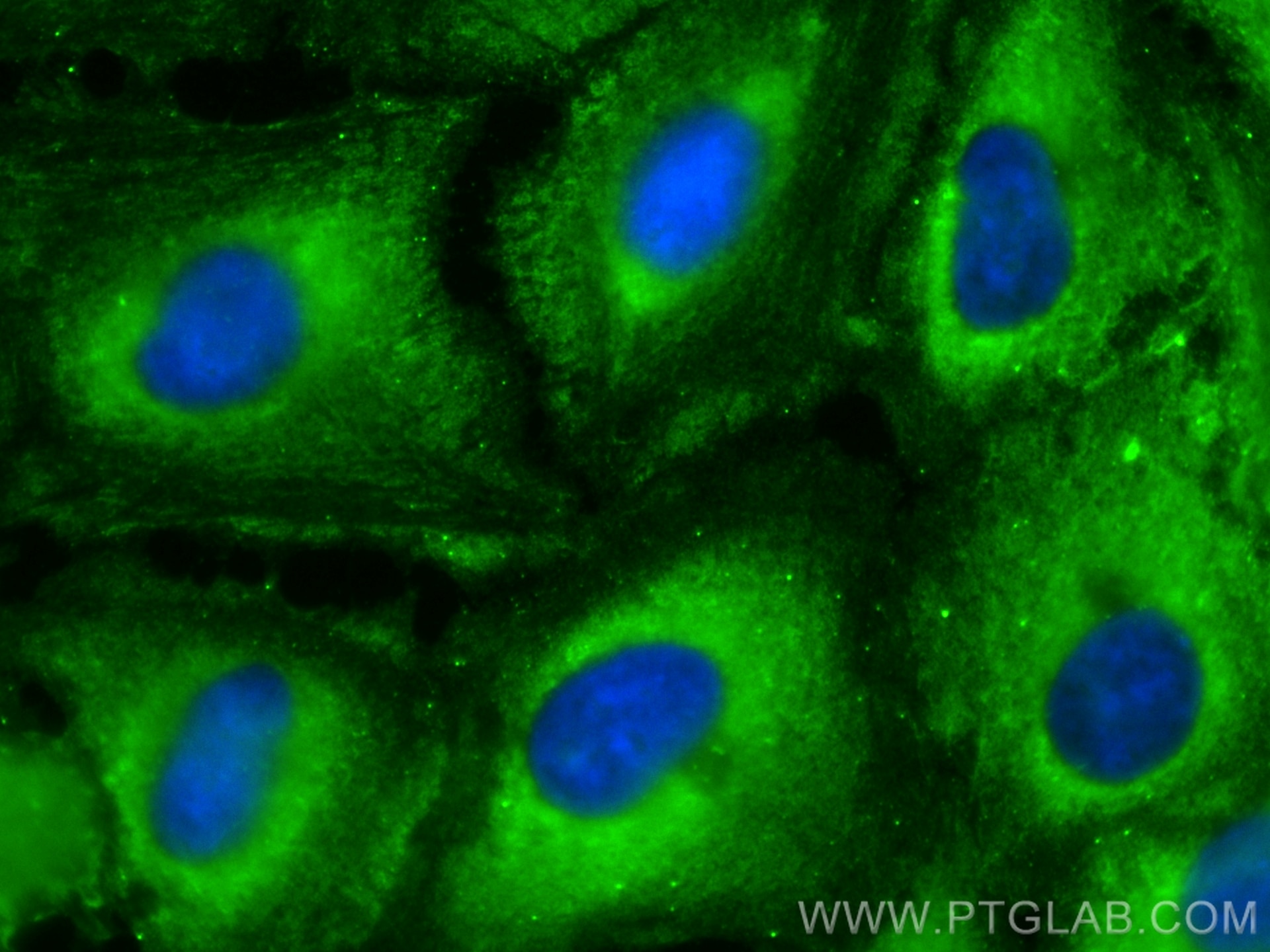 Immunofluorescence (IF) / fluorescent staining of A549 cells using CoraLite® Plus 488-conjugated RABEPK/p40 Monoclona (CL488-66622)