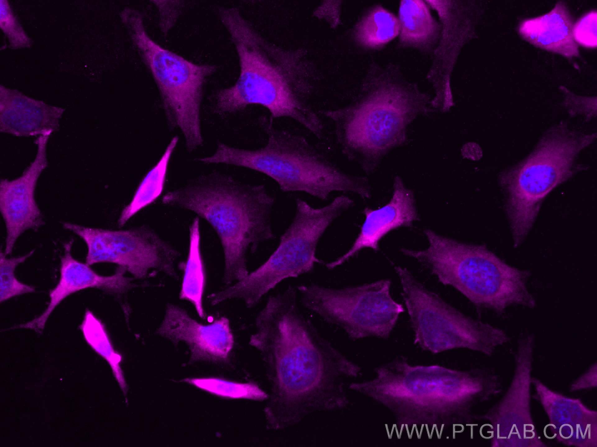 Immunofluorescence (IF) / fluorescent staining of HeLa cells using CoraLite® Plus 647-conjugated RABEPK/p40 Polyclona (CL647-15105)