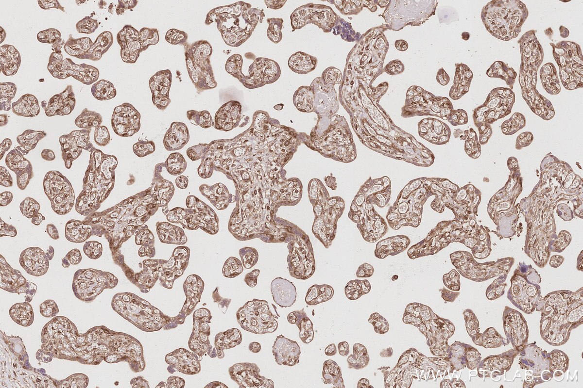 Immunohistochemistry (IHC) staining of human placenta tissue using RABGAP1 Polyclonal antibody (14223-1-AP)