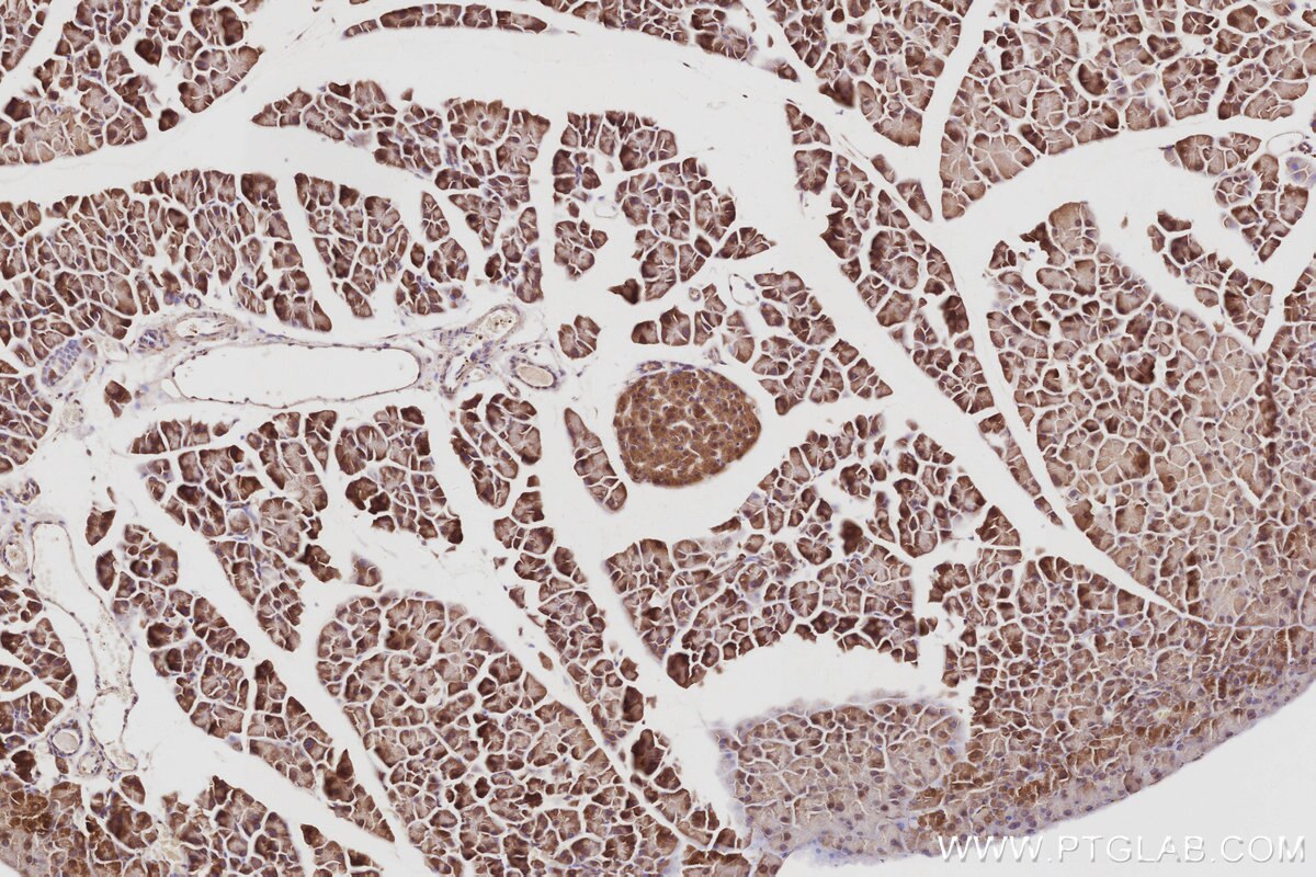 Immunohistochemistry (IHC) staining of mouse pancreas tissue using RABGAP1 Polyclonal antibody (14223-1-AP)