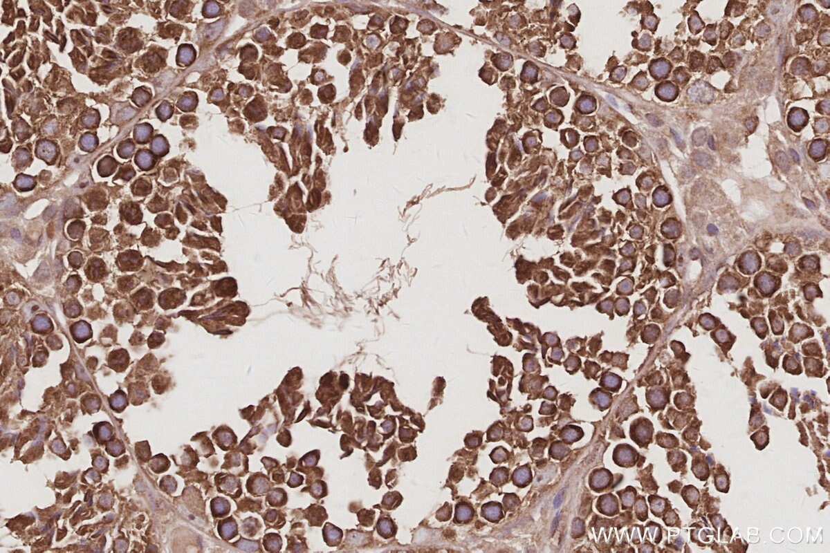 Immunohistochemistry (IHC) staining of mouse testis tissue using RABGAP1 Polyclonal antibody (14223-1-AP)