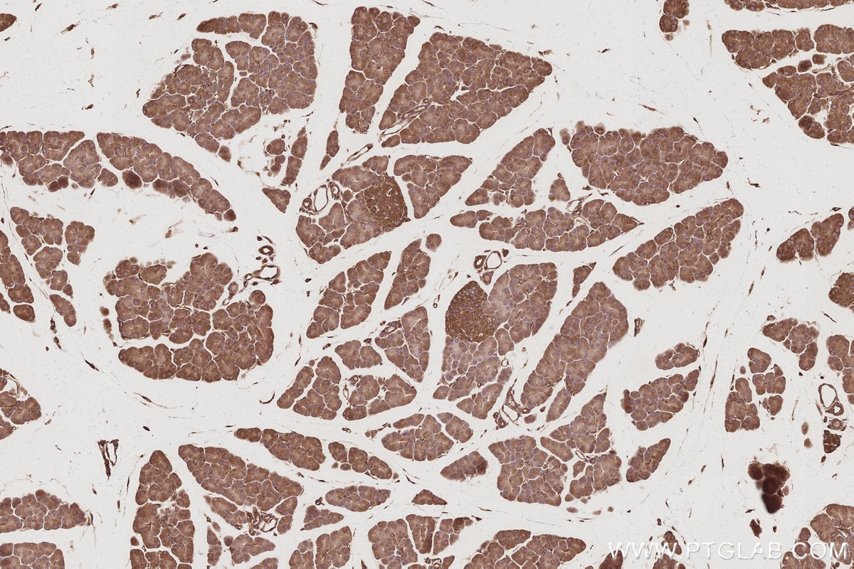 Immunohistochemistry (IHC) staining of rat pancreas tissue using RABGAP1 Polyclonal antibody (14223-1-AP)
