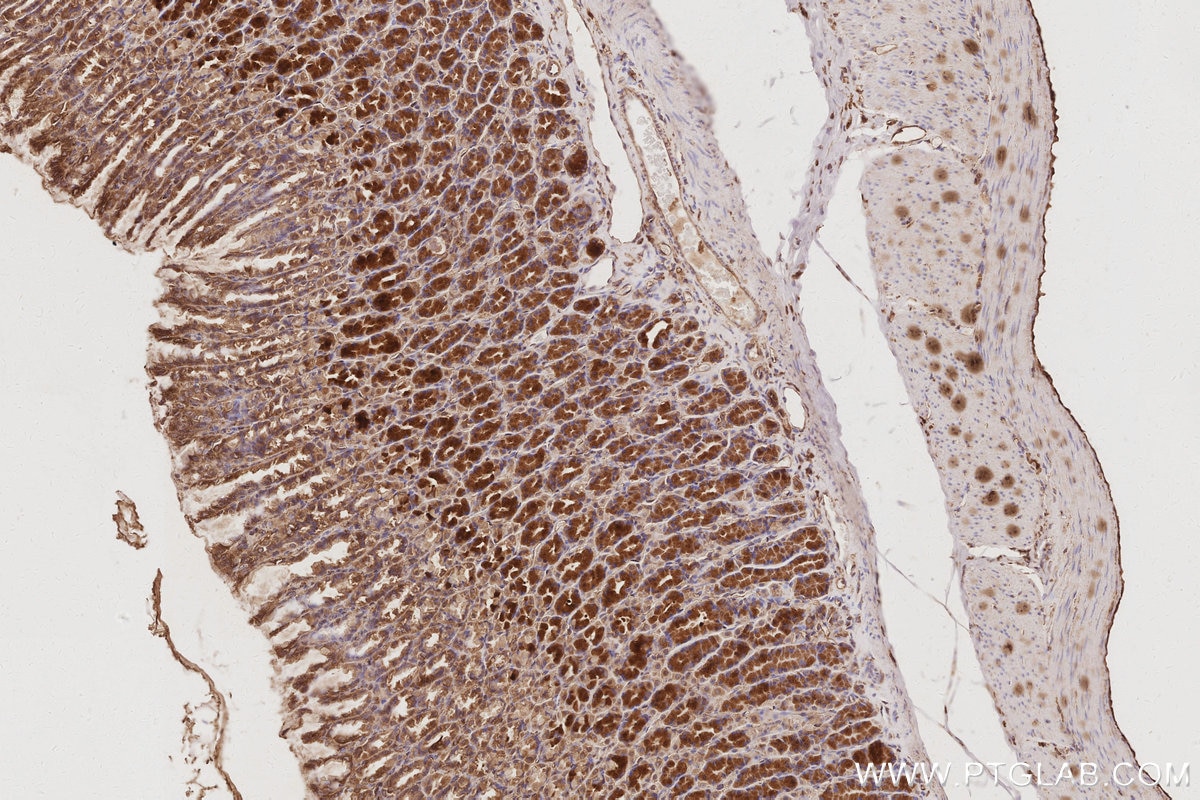 Immunohistochemistry (IHC) staining of rat stomach tissue using RABGAP1 Polyclonal antibody (14223-1-AP)