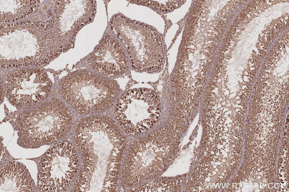 Immunohistochemistry (IHC) staining of rat testis tissue using RABGAP1 Polyclonal antibody (14223-1-AP)