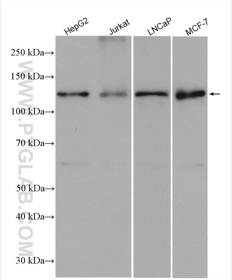 Western Blot (WB) analysis of various lysates using RABGAP1 Polyclonal antibody (14223-1-AP)