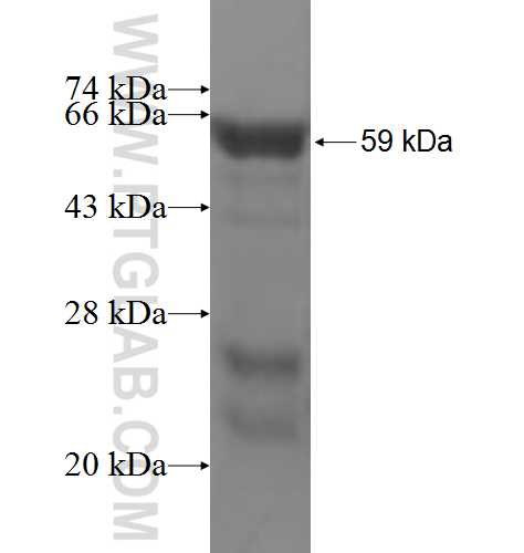 RABGAP1 fusion protein Ag5462 SDS-PAGE