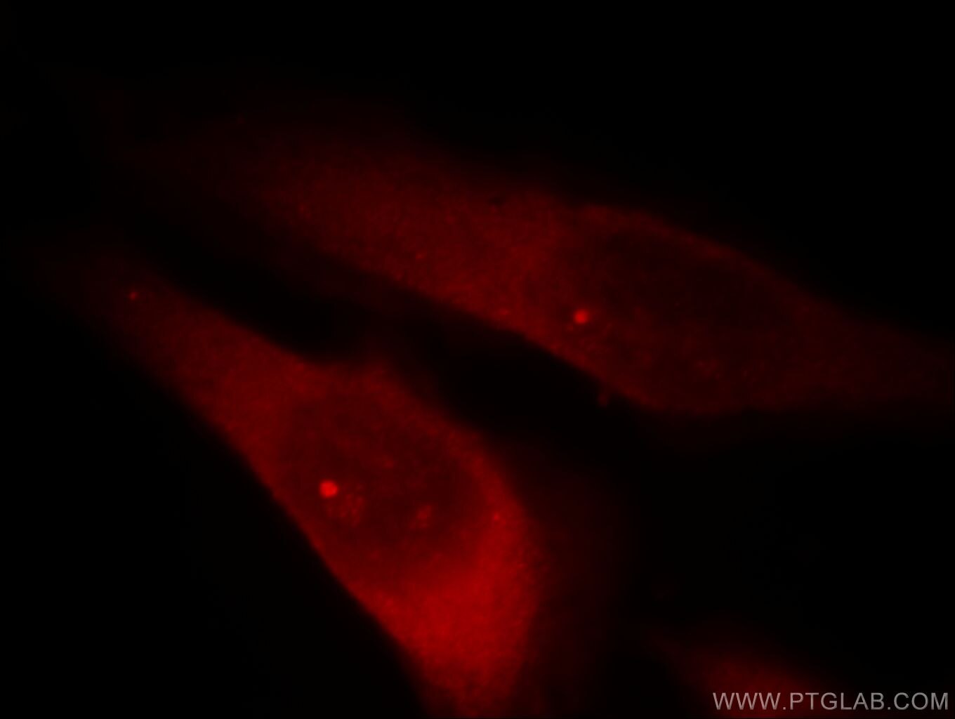 Immunofluorescence (IF) / fluorescent staining of HeLa cells using RABGAP1L Polyclonal antibody (13894-1-AP)