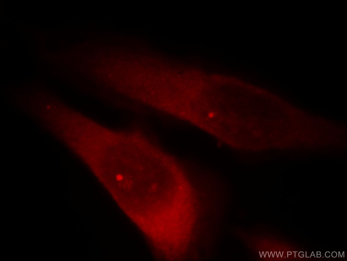 IF Staining of HeLa using 13894-1-AP