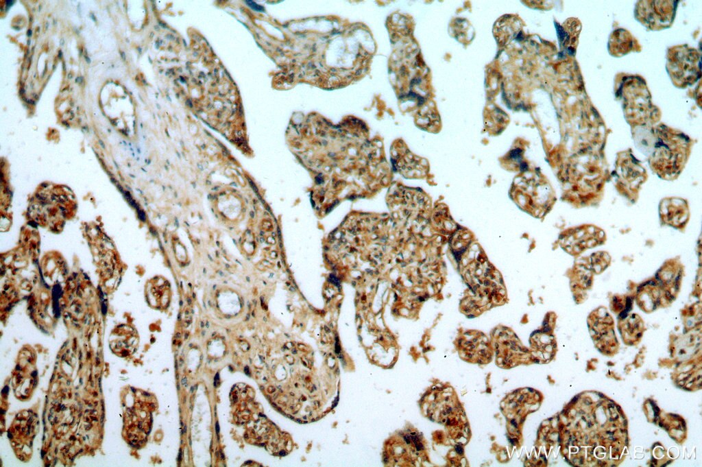 Immunohistochemistry (IHC) staining of human placenta tissue using RABGAP1L Polyclonal antibody (13894-1-AP)