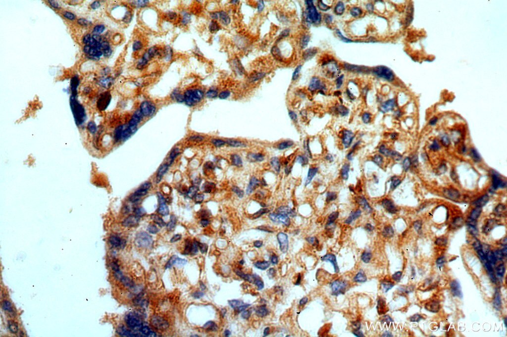 IHC staining of human placenta using 13894-1-AP